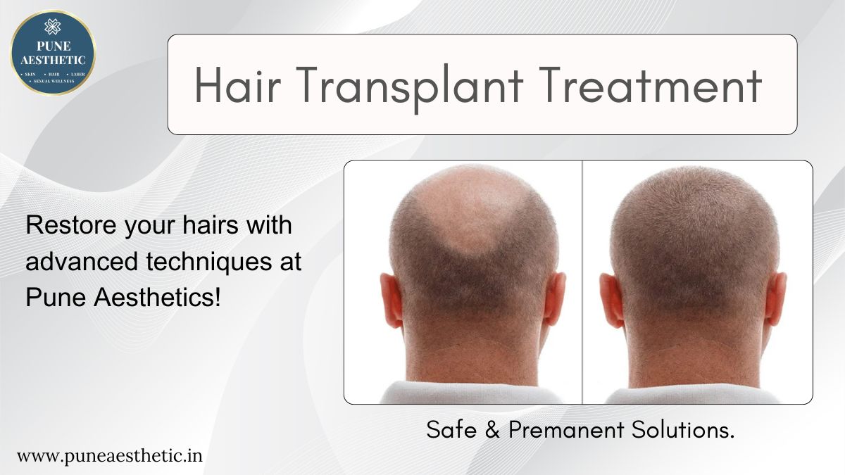 Hair Transplant Treatment in Pune: Procedure, Benefits, Results & Recovery Guide