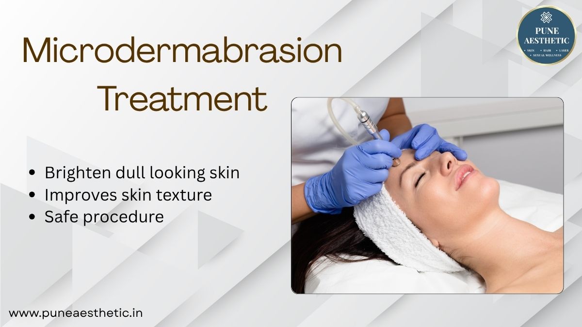 Microdermabrasion Treatment in Pune – Gentle Skin Resurfacing at Pune Aesthetic