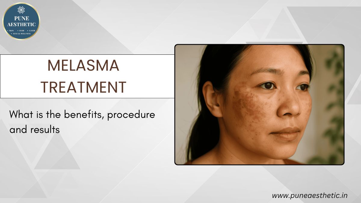 Melasma Treatment in Pune: Advanced Solutions for Clear, Even-Toned Skin