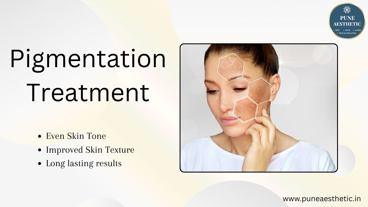Pigmentation Treatment in Pune – Achieve Clear, Even-Toned & Radiant Skin at Pune Aesthetic