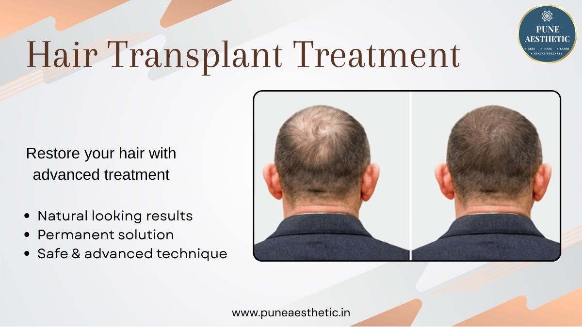 Hair Transplant in Pune – Advanced Hair Restoration Treatment at Pune Aesthetic