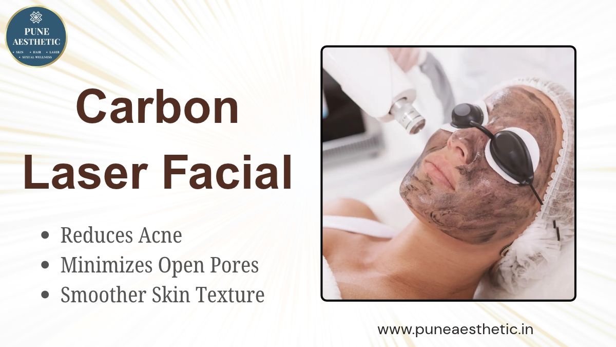 Carbon Laser Facial Treatment at Pune Aesthetic: Procedure, Benefits, Results, and Aftercare