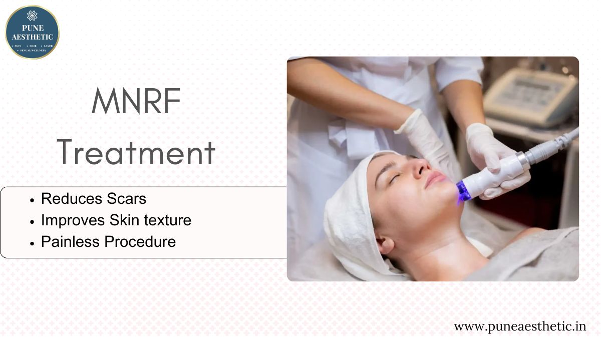 MNRF Treatment at Pune Aesthetic: Procedure, Benefits & Results