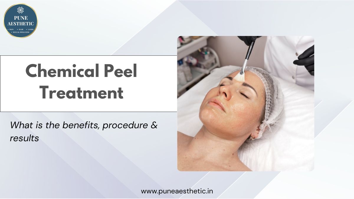 Best Chemical Peel Treatment in Pcmc: Reveal Clear, Radiant & Youthful Skin