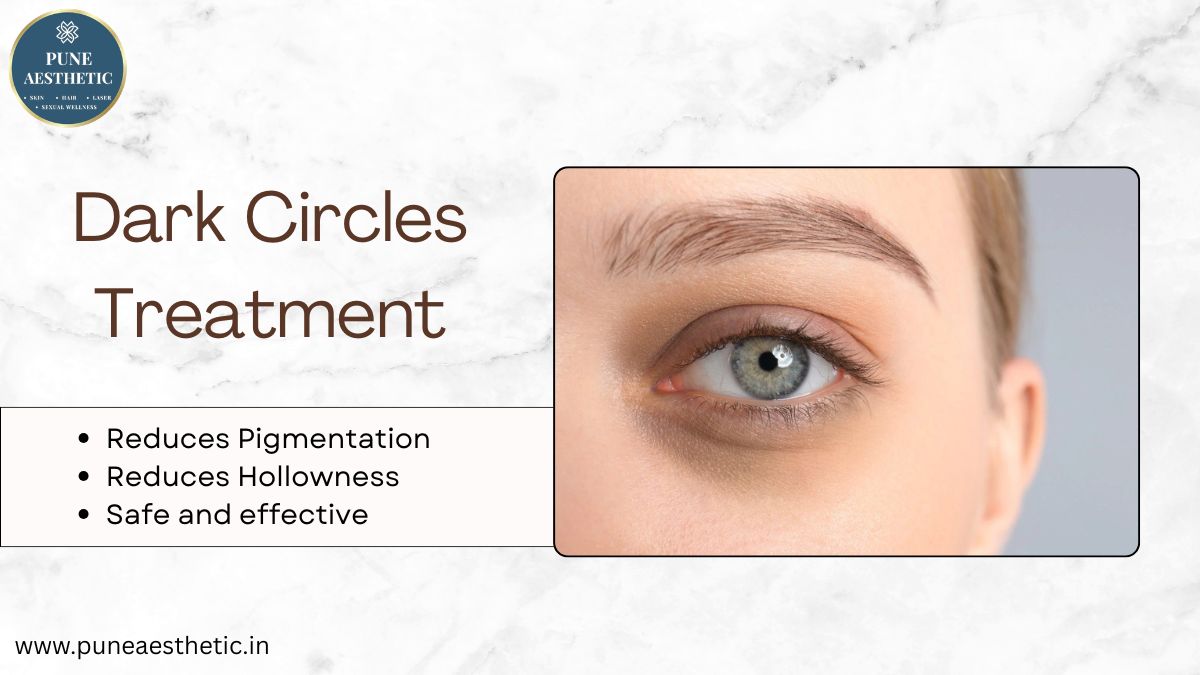 Dark Circles Treatment in Pune – Advanced Under-Eye Rejuvenation at Pune Aesthetic