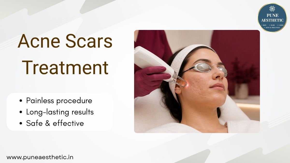Acne Scars Treatment in Pune – Advanced Scar Reduction at Pune Aesthetic