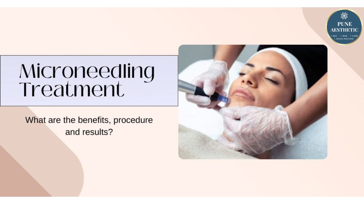 Microneedling Treatment near me: Revitalise Your Skin with Advanced Collagen Therapy