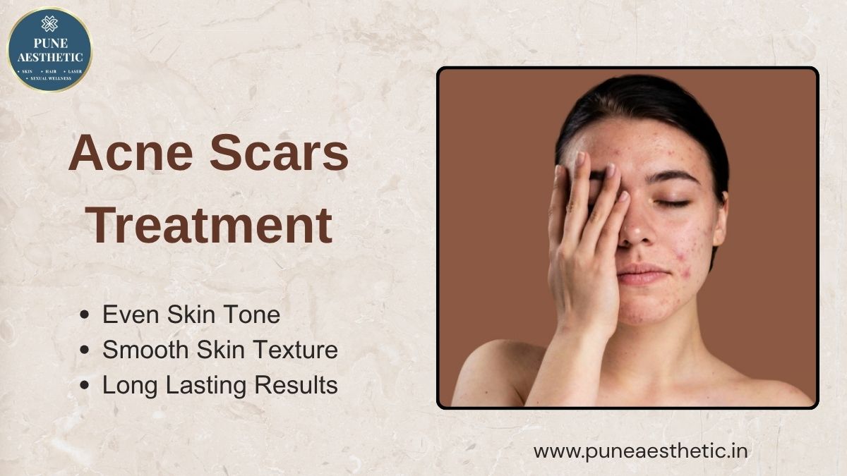 Acne Scar Treatment in Pune: Procedure, Benefits, Results & Aftercare