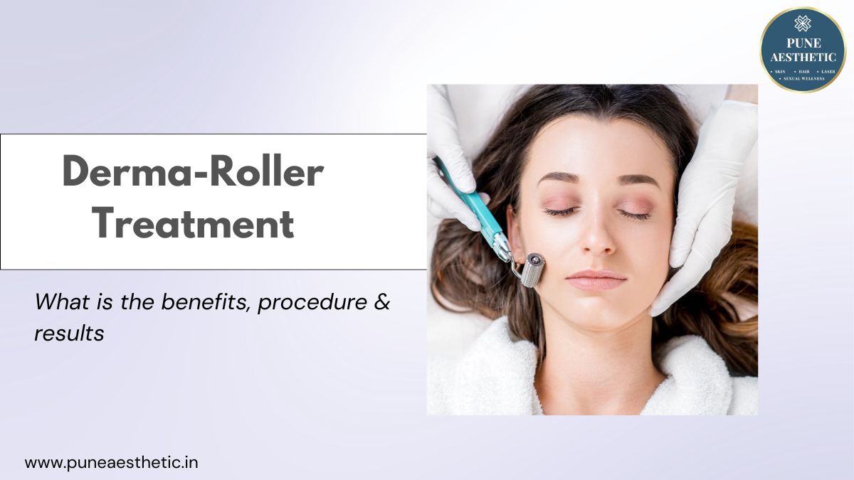 Advanced Derma Roller Treatment in Pcmc – Revitalize Your Skin Naturally!