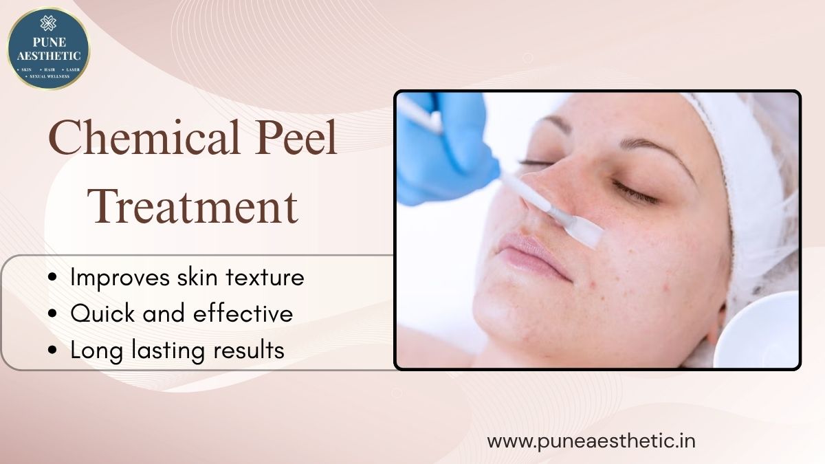 Best Chemical Peel Treatment: Procedure, Benefits, Results & Aftercare