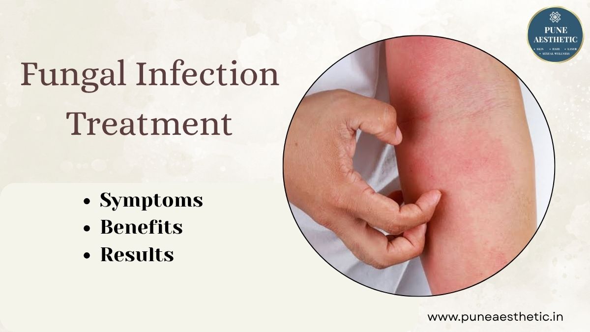 Fungal Infection Treatment in Pune: Effective Dermatological Care for Healthy Skin