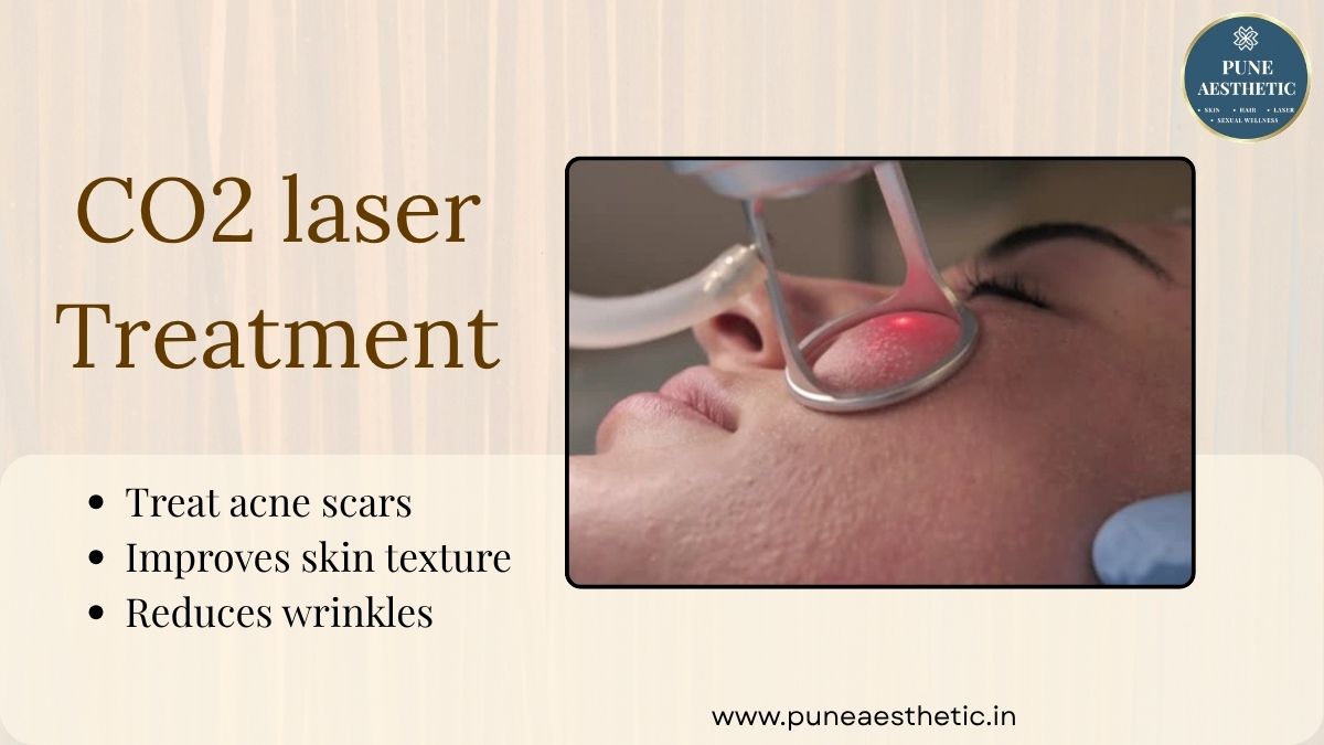 CO2 Laser Treatment in Pune: Advanced Skin Resurfacing for Smoother, Healthier-Looking Skin
