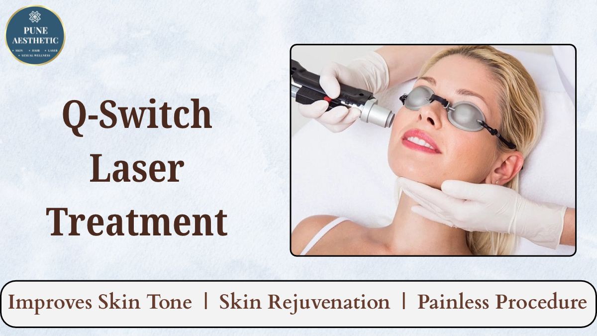 Q-Switch Laser Treatment at Pune Aesthetic – Effective Care for Pigmentation and Uneven Skin Tone