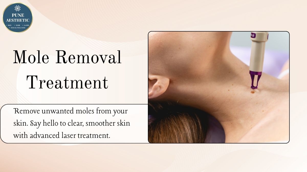 Mole Removal Treatment in Pune – Safe & Advanced Solutions at Pune Aesthetic