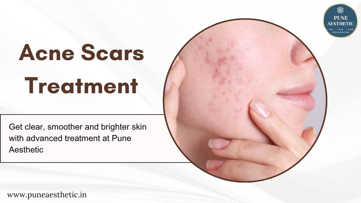Acne Scar Treatment in Pune: Procedure, Benefits & Complete Recovery Guide