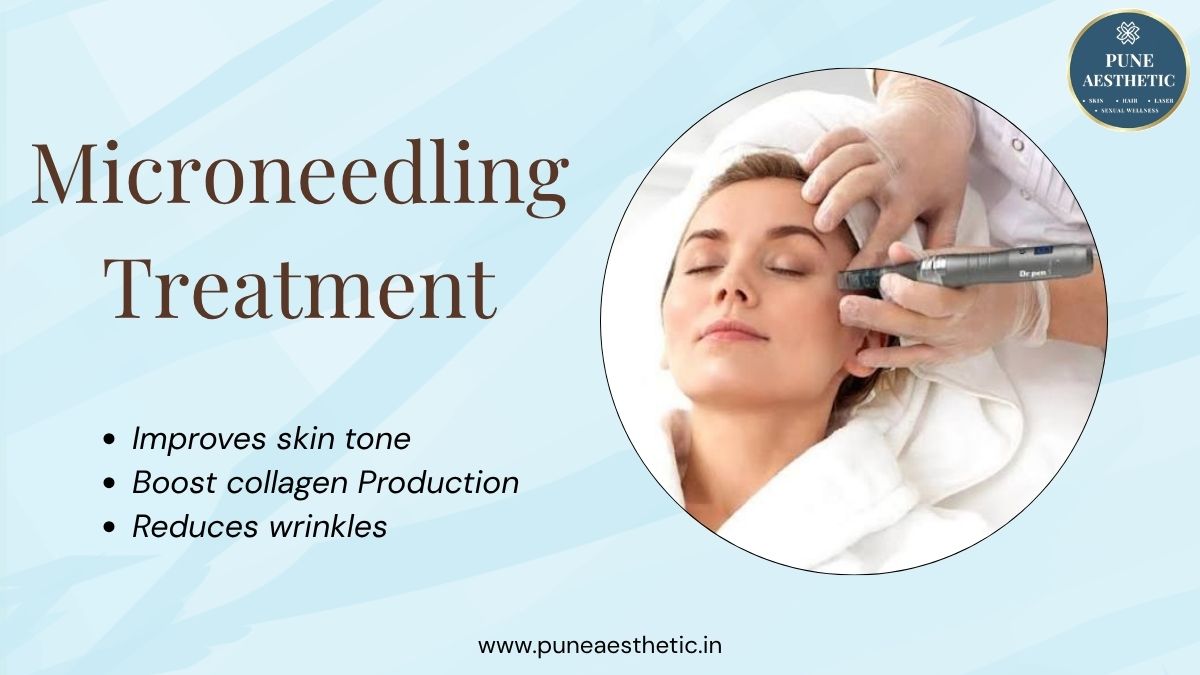 Microneedling Treatment in Pune – Advanced Skin Rejuvenation for Healthy, Radiant Skin at Pune Aesthetic