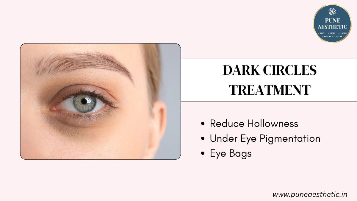 Dark Circles Treatment in Pune: Procedure, Benefits, Results at Pune Aesthetic
